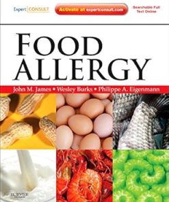 Food Allergy By John M James