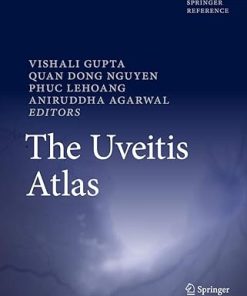 The Uveitis Atlas