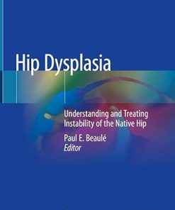 Hip Dysplasia