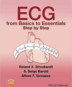 ECG from Basics to Essentials Step by Step