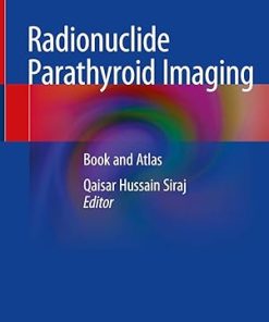 Radionuclide Parathyroid Imaging