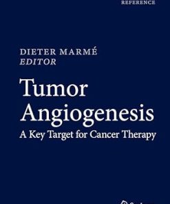 Tumor Angiogenesis