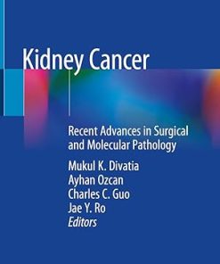 Kidney Cancer