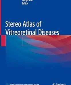 Stereo Atlas of Vitreoretinal Diseases