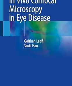 In Vivo Confocal Microscopy in Eye Disease