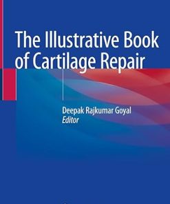 The Illustrative Book of Cartilage Repair
