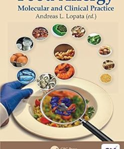 Food Allergy Molecular and Clinical Practice