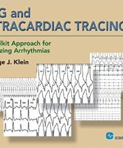 ECG and Intracardiac Tracings A Toolkit Approach for Analyzing Arrhythmias