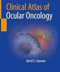 Clinical Atlas of Ocular Oncology