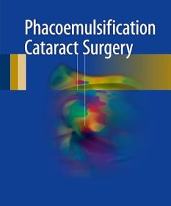 Phacoemulsification Cataract Surgery