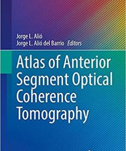 Atlas of Anterior Segment Optical Coherence Tomography