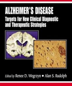 Alzheimers Disease Targets for New Clinical Diagnostic and Therapeutic Strategies