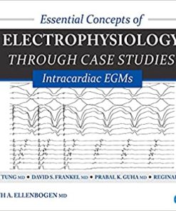 Essential Concepts of Electrophysiology Through Case Studies Intracardiac EGMs