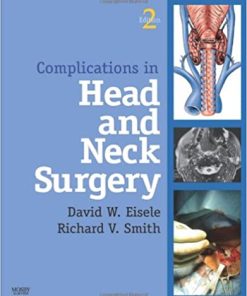 Complications in Head and Neck Surgery 2nd Edition