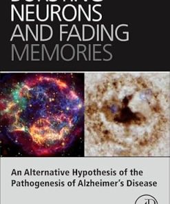 Bursting Neurons and Fading Memories An Alternative Hypothesis of the Pathogenesis of Alzheimers Disease