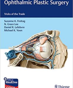 Ophthalmic Plastic Surgery Tricks of the Trade