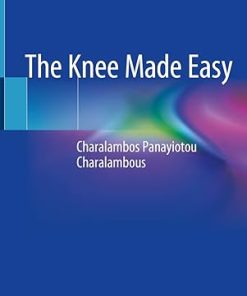 The Knee Made Easy