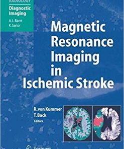 Magnetic Resonance Imaging in Ischemic Stroke