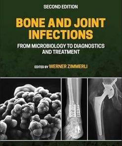 Bone and Joint Infections