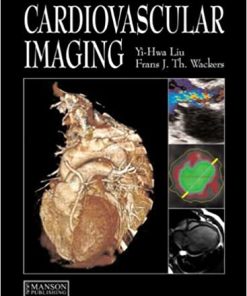 Cardiovascular Imaging