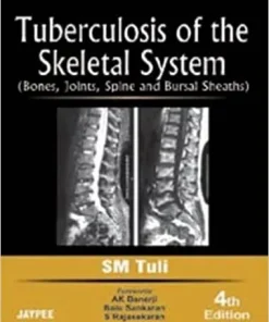 Tuberculosis of the Skeletal System Bones Joints Spine and Bursal Sheaths 4th Edition