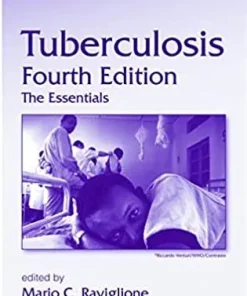 Tuberculosis The Essentials 4th Edition