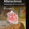 Asymptomatic Atherosclerosis Pathophysiology Detection and Treatment