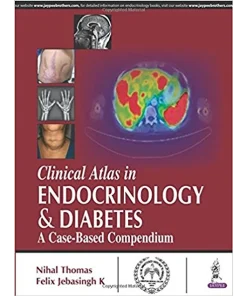 Clinical Atlas in Endocrinology & Diabetes A Case-Based Compendium
