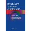 Detection and Assessment of Dental Caries