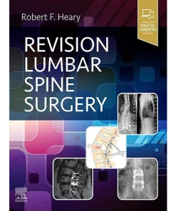 Revision Lumbar Spine Surgery