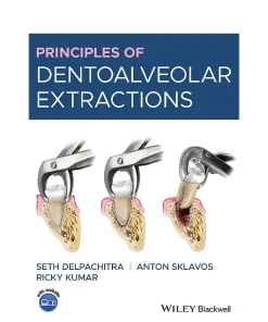 Principles of Dentoalveolar Extractions