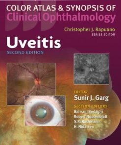 Color Atlas and Synopsis of Clinical Ophthalmology Uveitis 2nd Edition