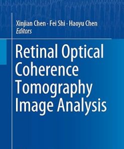 Retinal Optical Coherence Tomography Image Analysis