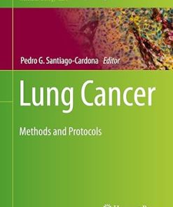 Lung Cancer