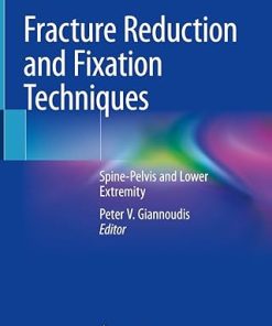Fracture Reduction and Fixation Techniques