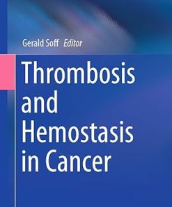 Thrombosis and Hemostasis in Cancer