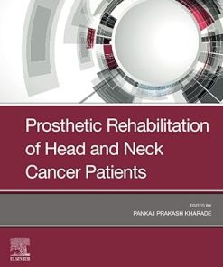 Prosthetic Rehabilitation of Head and Neck Cancer Patients