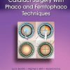 Cataract Surgery With Phaco and Femtophaco Techniques