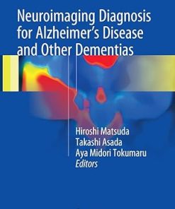 Neuroimaging Diagnosis for Alzheimers Disease and Other Dementias