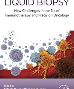 Liquid Biopsy