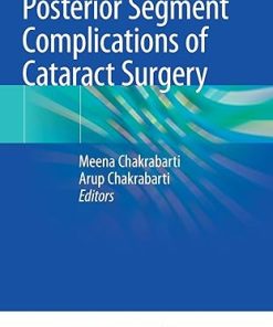 Posterior Segment Complications of Cataract Surgery