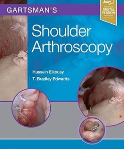Shoulder Arthroscopy