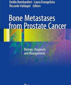 Bone Metastases from Prostate Cancer