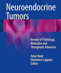 Neuroendocrine Tumors
