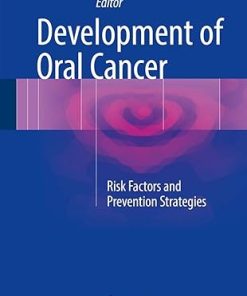 Development of Oral Cancer