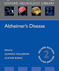 Alzheimers Disease 2nd Edition