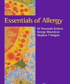 Essentials of Allergy