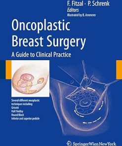 Oncoplastic Breast Surgery