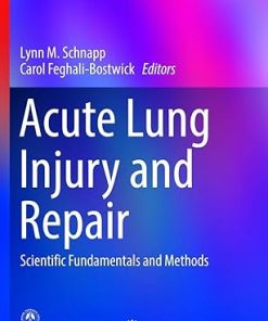 Acute Lung Injury and Repair Scientific Fundamentals and Methods