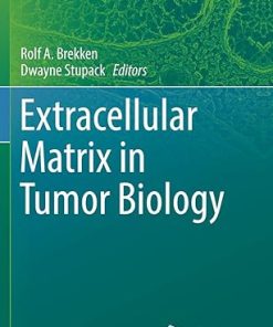 Extracellular Matrix in Tumor Biology